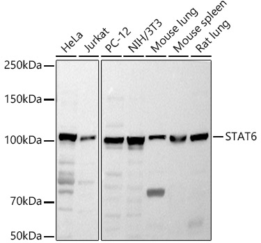 STAT6 Rabbit pAb