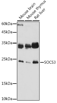 SOCS3 Rabbit pAb