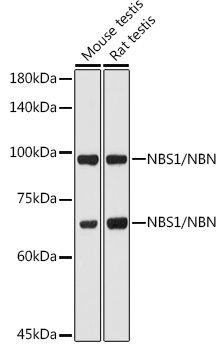 [KO Validated] NBS1/NBN Rabbit pAb