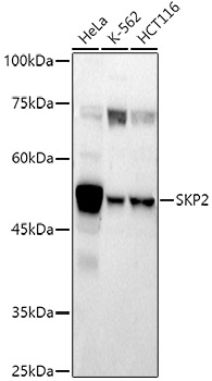 SKP2 Rabbit pAb