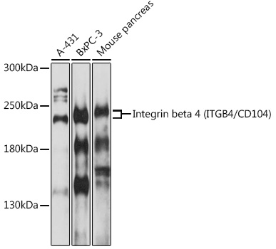 Integrin beta 4 (ITGB4/CD104) Rabbit pAb