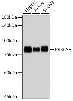 PRKCSH Rabbit mAb