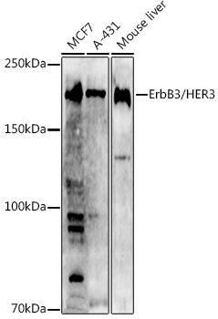 [KO Validated] ErbB3/HER3 Rabbit pAb