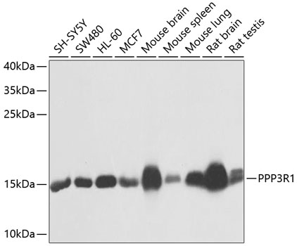 PPP3R1 Rabbit pAb