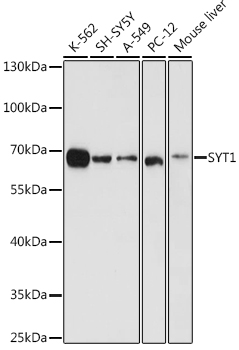 SYT1 Rabbit pAb