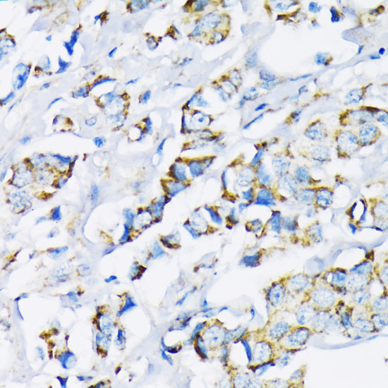 Hexokinase II Rabbit pAb