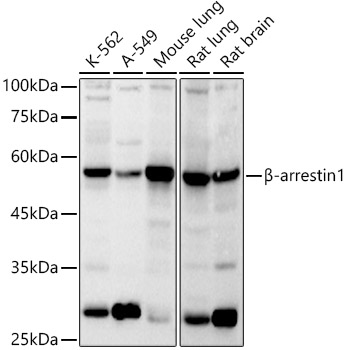 _-arrestin1 Rabbit pAb