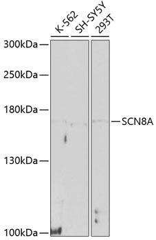 SCN8A Rabbit pAb