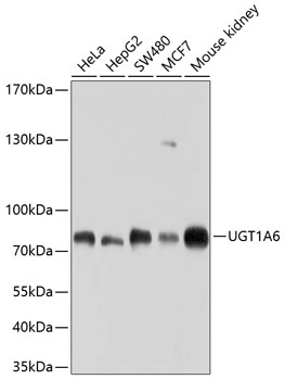 UGT1A6 Rabbit pAb