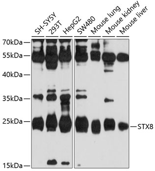 STX8 Rabbit pAb