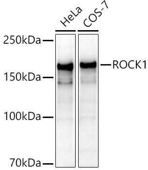 [KO Validated] ROCK1 Rabbit pAb