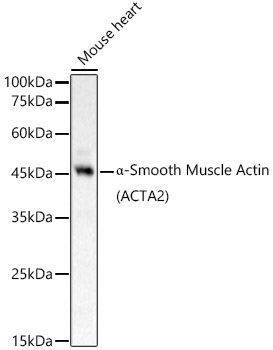 _-Smooth Muscle Actin (ACTA2) Rabbit pAb
