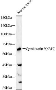 Cytokeratin 9 (KRT9) Rabbit pAb