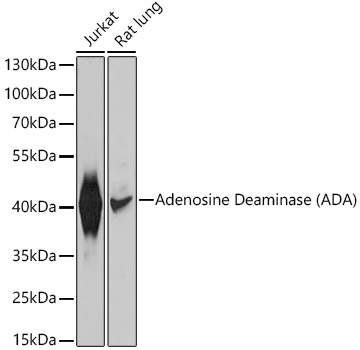 Adenosine Deaminase (ADA) Rabbit pAb
