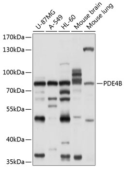 PDE4B Rabbit pAb