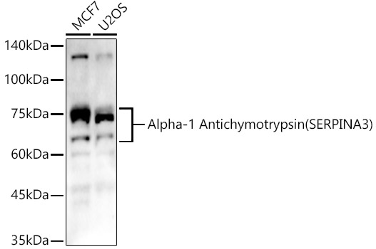 Alpha-1 Antichymotrypsin (SERPINA3) Rabbit pAb