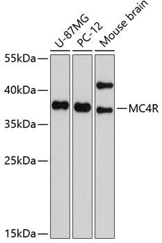 MC4R Rabbit pAb