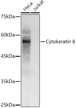 Cytokeratin 8 (KRT8) Rabbit pAb