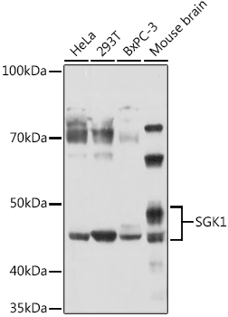SGK1 Rabbit pAb