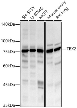 TBX2 Rabbit pAb