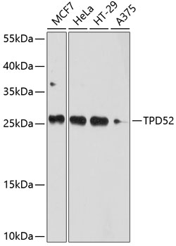 TPD52 Rabbit pAb