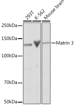 Matrin 3 Rabbit mAb