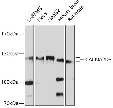 CACNA2D3 Rabbit pAb