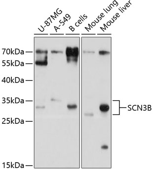 SCN3B Rabbit pAb
