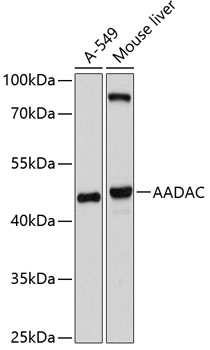 AADAC Rabbit pAb