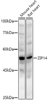 ZIP14 Rabbit pAb