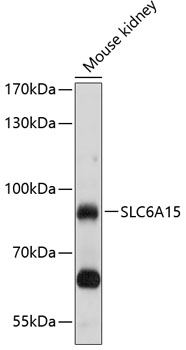 SLC6A15 Rabbit pAb