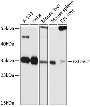 EXOSC2 Rabbit pAb