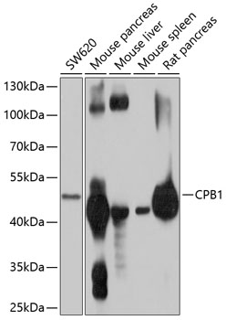 CPB1 Rabbit pAb