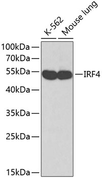 IRF4 Rabbit pAb