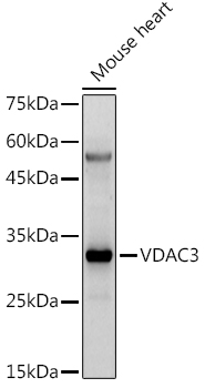 VDAC3 Rabbit pAb