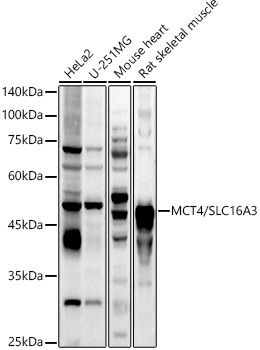 MCT4/SLC16A3 Rabbit pAb