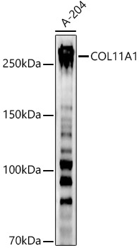 COL11A1 Rabbit pAb