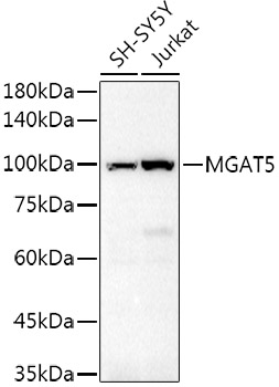 GNT-V/MGAT5 Rabbit pAb