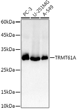 TRMT61A Rabbit pAb