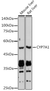 CYP7A1 Rabbit pAb