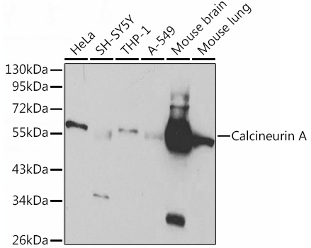 Calcineurin A Rabbit pAb