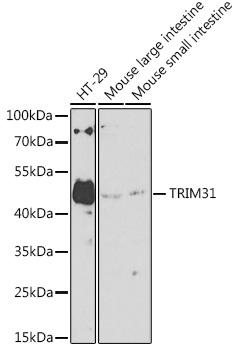 TRIM31 Rabbit pAb