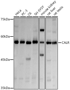 Calreticulin Rabbit pAb