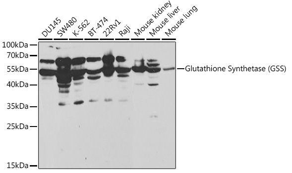 Glutathione Synthetase (GSS) Rabbit pAb