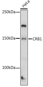 CRB1 Rabbit pAb