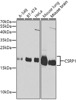 CSRP1 Rabbit pAb