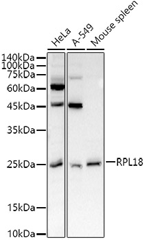 RPL18 Rabbit pAb