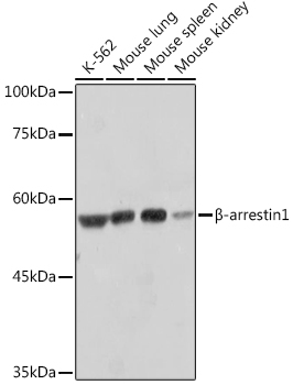 _-arrestin1 Rabbit mAb