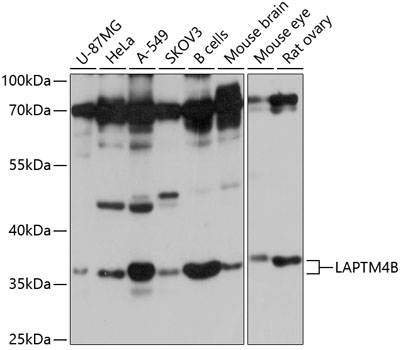 LAPTM4B Rabbit pAb