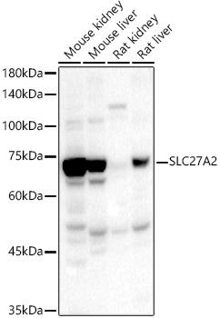 SLC27A2 Rabbit pAb